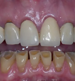 Implantati ljubljana okolica