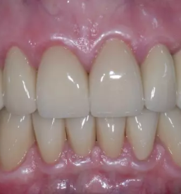 Implantati ljubljana okolica