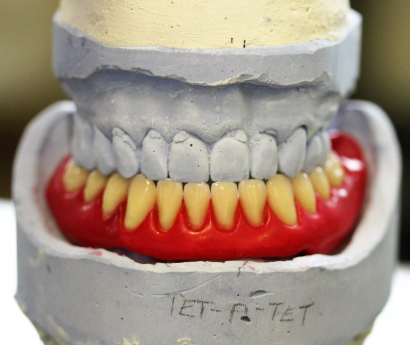 Mnogi zadovoljni pacienti vam bodo potrdili, da smo prava izbira, če iščete, kateri je dober in dostopen zasebni zobozdravnik v Ljubljani z okolico