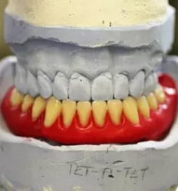 Zobna protetika ljubljana okolica