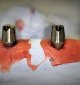 Zasebno zobozdravstvo Ljubljana