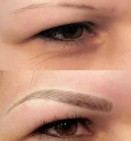 Ugodna depilacija ljubljana bezigrad