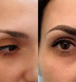 Ugodna depilacija ljubljana bezigrad