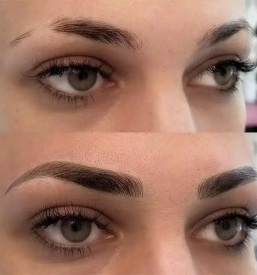 Ugodna depilacija ljubljana bezigrad