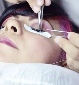 Ugodni microneedling ljubljana center