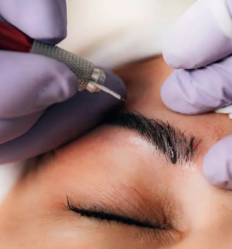 Ugodni microneedling ljubljana center