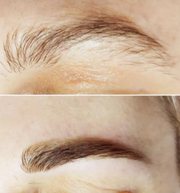 Nitkanje obraza maribor okolica