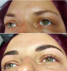 Nitkanje obraza maribor okolica