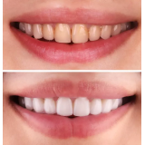 Emira Bećirbegović s.p.