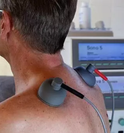 Cupping terapije pomurje