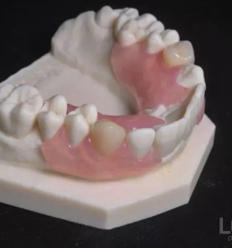 Brezkovinske protetične rešitve Ljubljana, Osrednja Slovenija