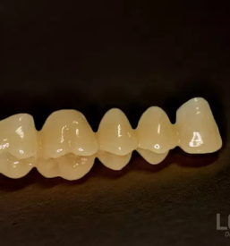 Brezkovinske protetične rešitve Ljubljana