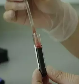 Napredne celične terapije v Sloveniji