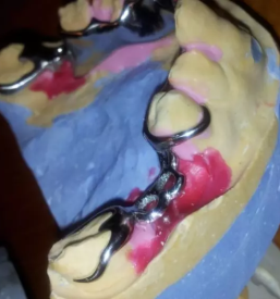 Zdravljenje zob v Kranju