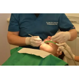 BDENT, zobozdravstvena dejavnost Dominik Blatnik s.p.