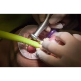 VESNA ŠEGA - NOVAK, DR. DENT. MED., ZASEBNA ZOBNA ORDINACIJA