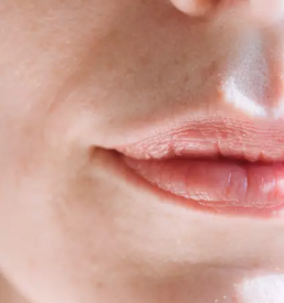 Prodaja dermalnih dopolnil s hialuronsko kislino slovenija