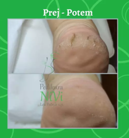 Ugodna pedikura Posavje