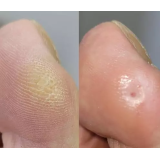 ZDRAV DOTIK, PEDIKURA IN MASAŽE, POLONA FILIPIČ S.P.