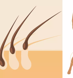 Ugodna depilacija ljubljana fuzine