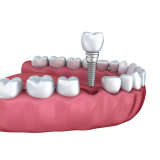 SABINA DRAGOVAN, S.P.
