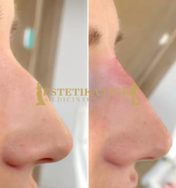 Filerji Ljubljana, Trzin