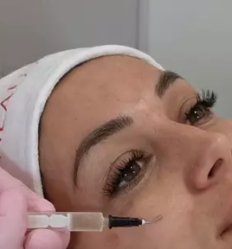 Polnila in filerji Ljubljana