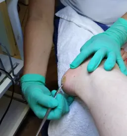 Medicinska pedikura Osrednja Slovenija