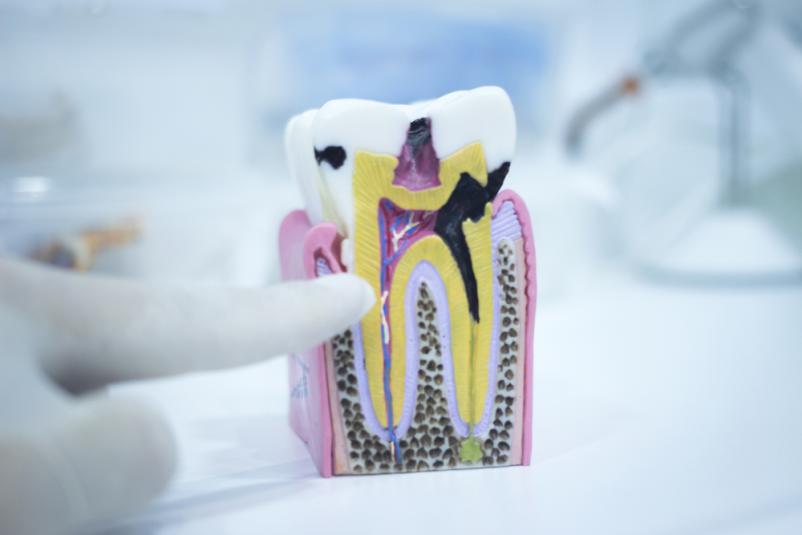 endodontologija je ena od vej zobozdravstva, ki jo izvajamo v Domžalah