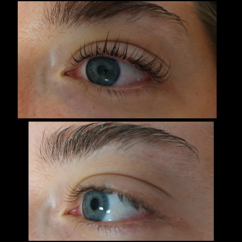 Keratinsko vihanje trepalnic Ljubljana BTC