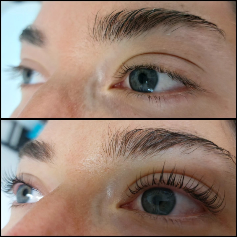 Vihanje trepalnic keratin Ljubljana