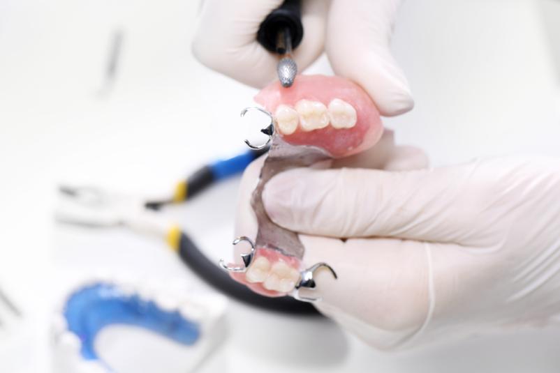 Dober zobozdravnik in nevidni ortodontski aparat