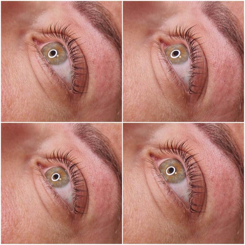 Keratinsko vihanje trepalnic Celje