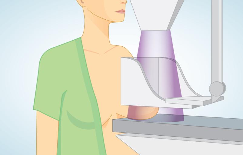 Samoplačniška mamografija Ljubljana