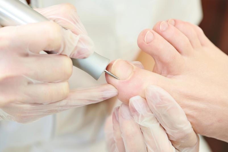 Kakovostna medicinska pedikura Ljubljana okolica