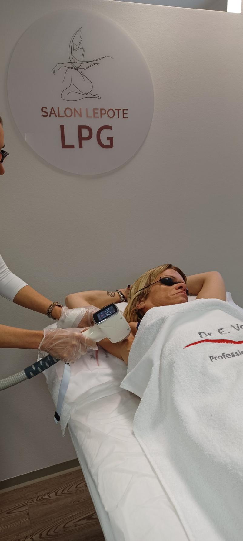 laser za odstranjevanje dlak