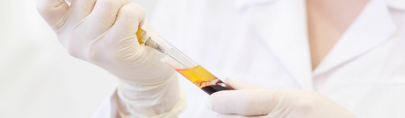 Prosti termini Klinika za sklepe, hrbtenico in poškodbe Ljubljana Maribor