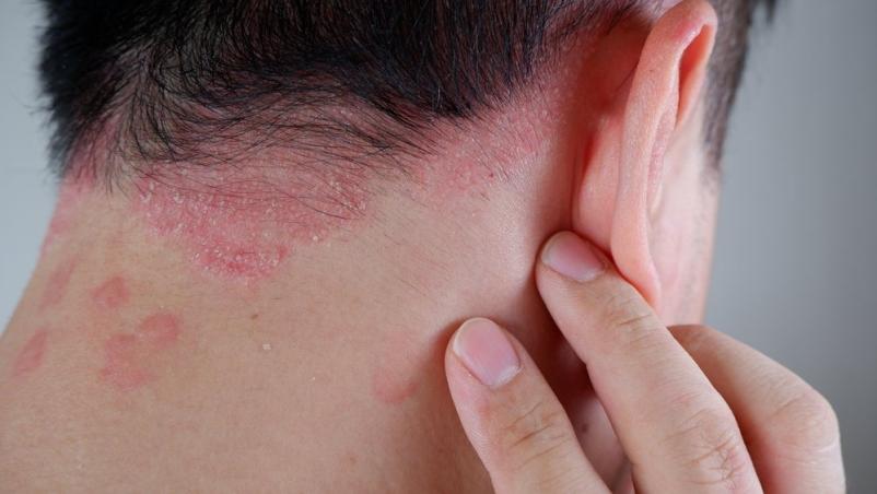 Dermatolog