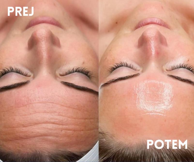 Estetski terapevt Izola, Obala