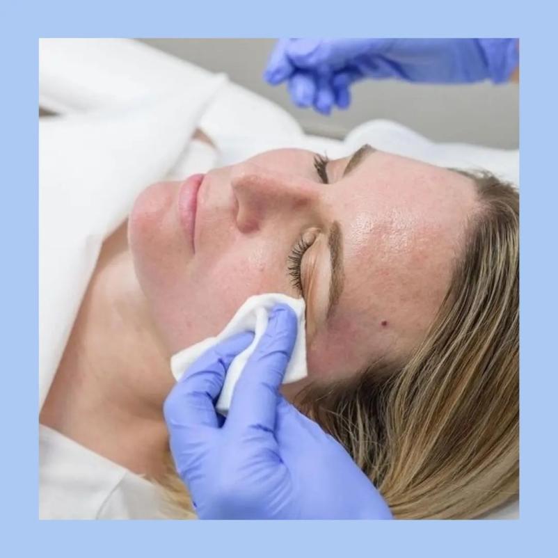 Profesionalna nega obraza Izola, Obala