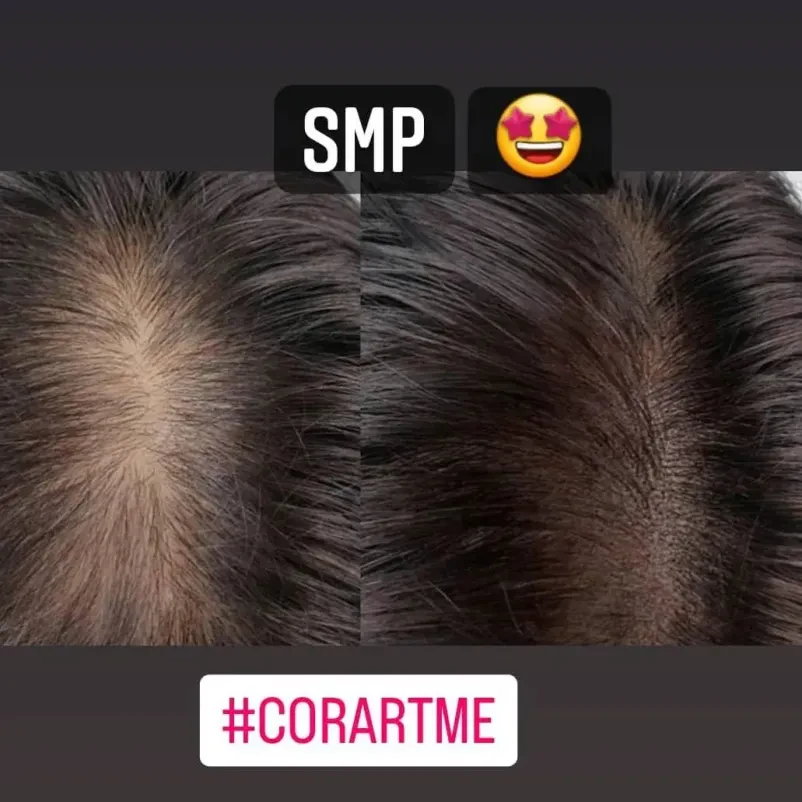 Presajanje las
