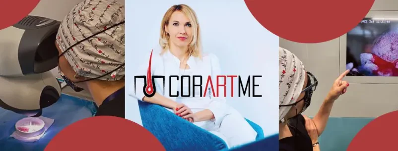 Transplantacija kose na Balkan