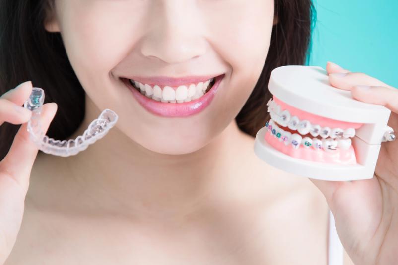 Invisalign zobni aparat Primorska