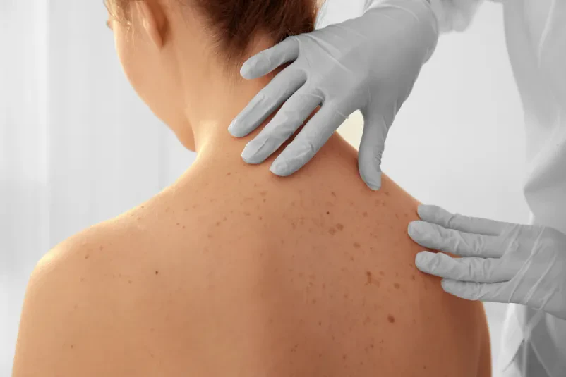Dermatologo privato economico