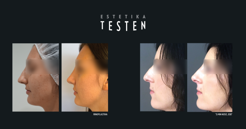 Estetika Testen je pravi naslov za kvalitetno estetsko kirurgijo v Sloveniji