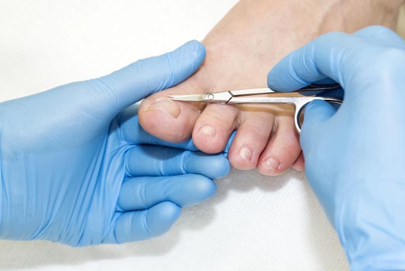 Za medicinsko in estetsko pedikuro smo vam na Pomurskem vedno na voljo