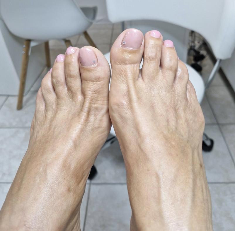 Za medicinsko pedikuro v Mariboru nas kontaktirajte