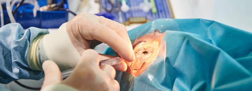 operacije oči Nova Gorica