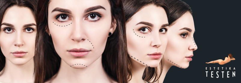 Pomlajevanje obraza Štajerska