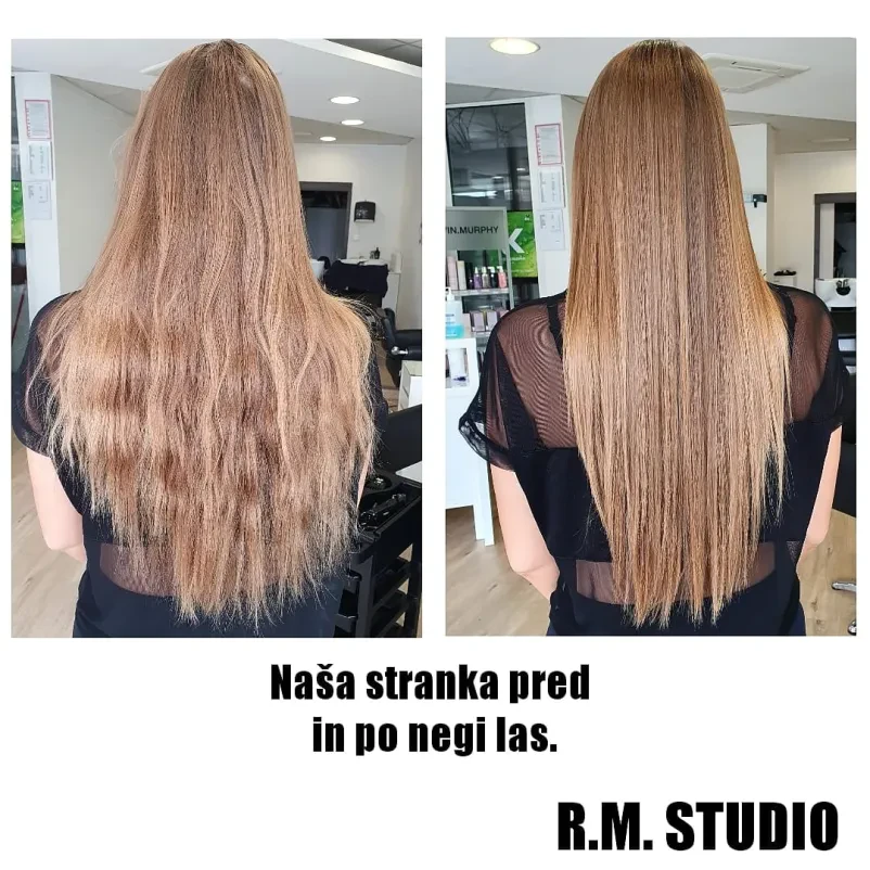 Lasni botoks Pivka